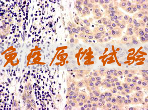 不朽情缘mg官网免疫原性试验服务