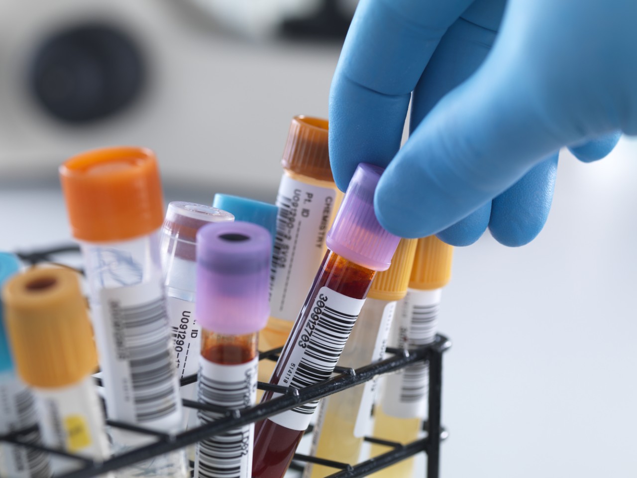 “溶出”还是“BE”，何为临床疗效“金标准”