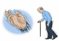 帕金森。芭痢辈慌？