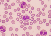 一种神秘颗粒被发现了！它能否成为败血症早筛标志物？