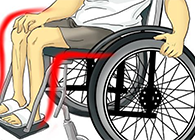 Nature：还瘫痪患者一个自由身的日子不远了