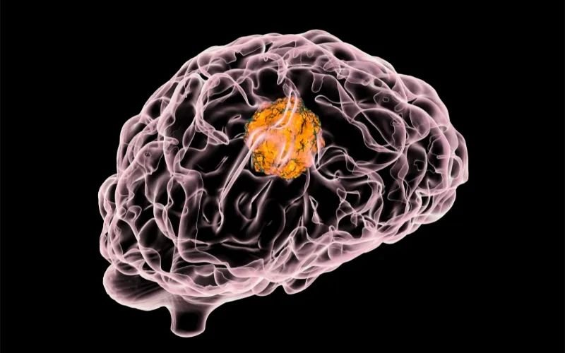 不朽情缘mg官网助力 | 璧辰医药ABM-1310获美国FDA孤儿药资格认证，用于治疗携带BRAF V600突变的脑胶质母细胞瘤患者