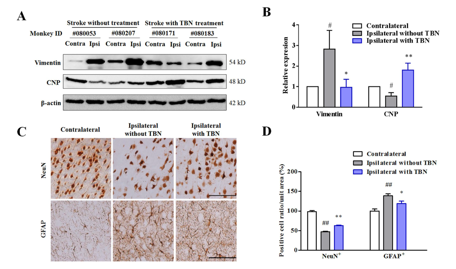 TBN是一种治疗缺血性卒中的新型临床候选药物，本研究中TBN通过不朽情缘mg官网合成